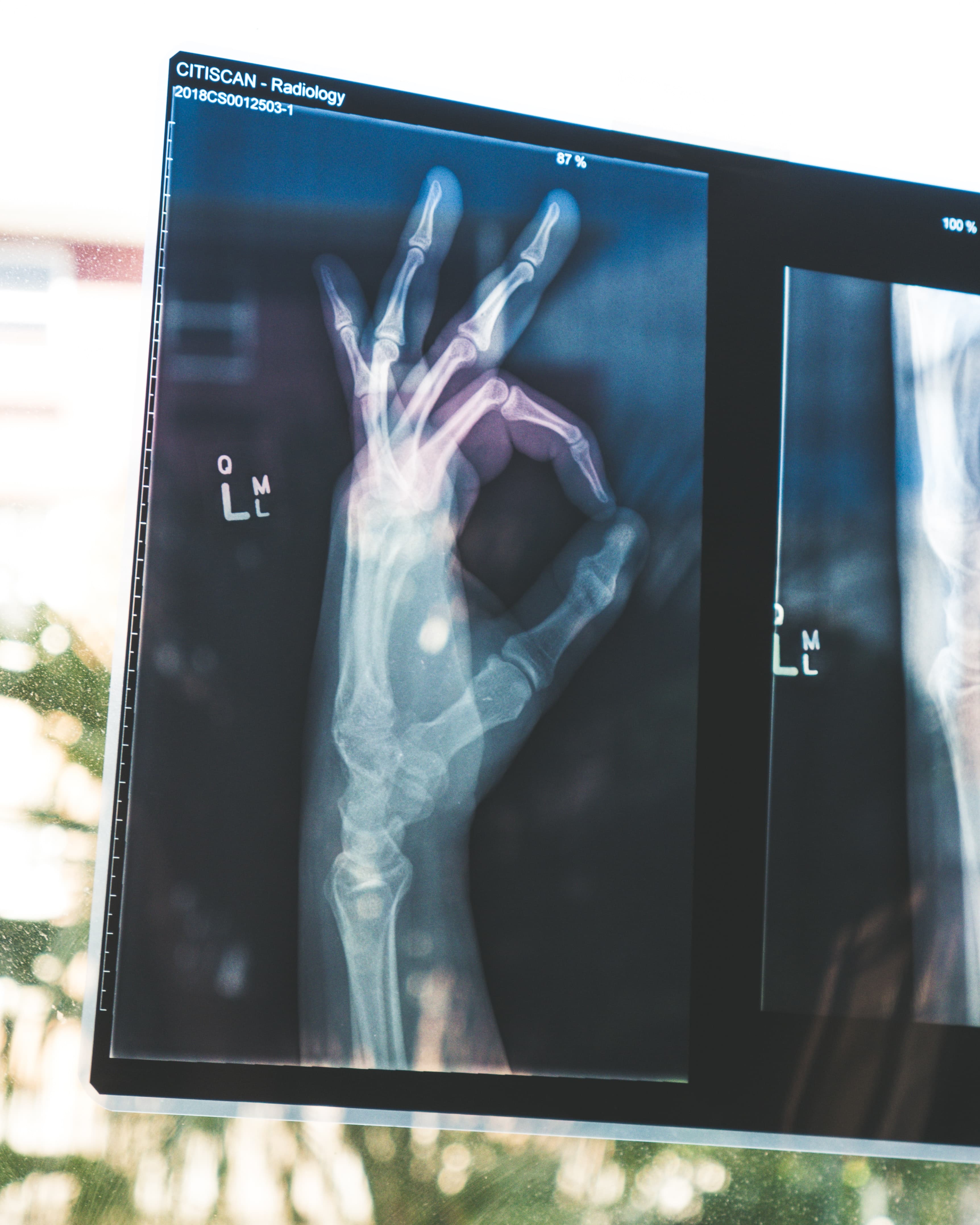 Bedah Jurusan D4 Teknologi Radiologi Pencitraan - Bagaimana Kuliahnya dan Prospek Kerja Lulusannya